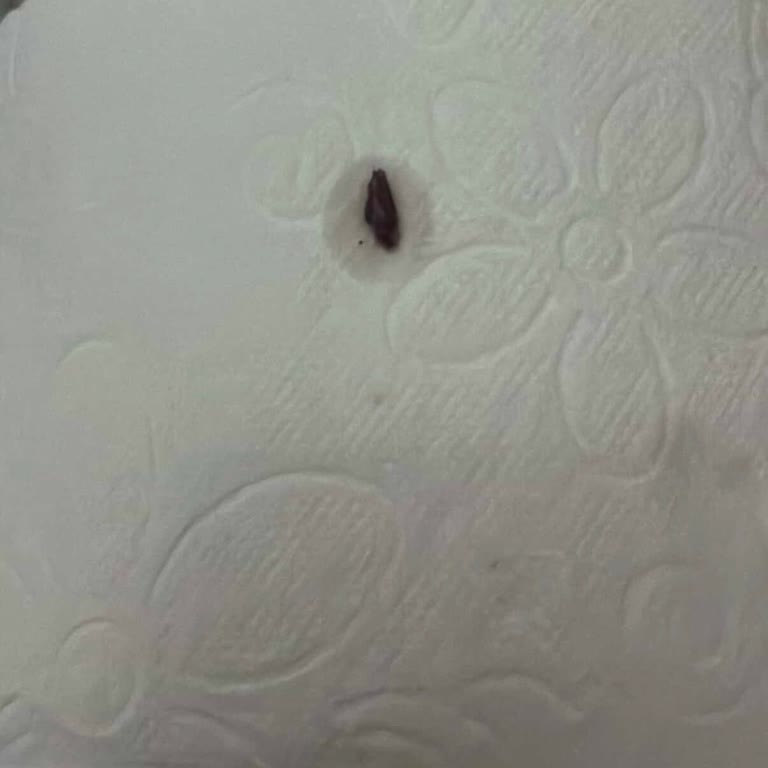 Pepsi Şişesinde Yabancı Madde Ve Eksik Ürün Bilgisi Endişesi