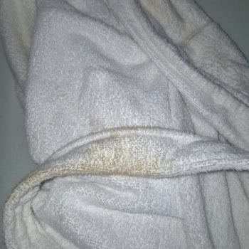 Üsküdar'da Şebeke Suyunda Ciddi Kirlilik Ve Sağlık Sorunları