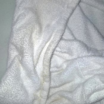 Üsküdar'da Şebeke Suyunda Ciddi Kirlilik Ve Sağlık Sorunları