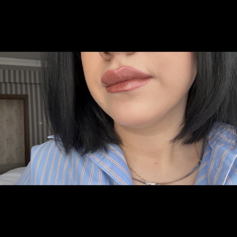 Botoks Ve Dudak Dolgusu Beklenenden Hızlı Etkisini Kaybetti, Kliniğe Ulaşılamıyor