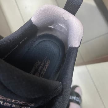 Skechers Ayakkabıda Hızlı Deformasyon Ve Mağduriyet