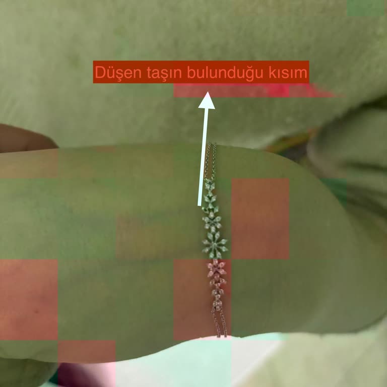 Aldığım Bileklikte Sürekli Taş Düşmesi Ve Yetersiz Müşteri Hizmeti