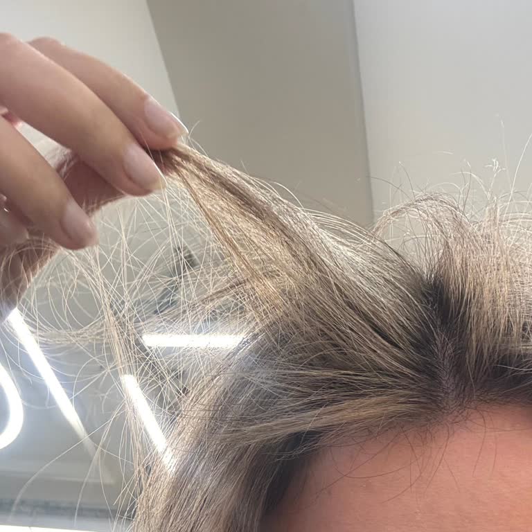 Saçım Yandı, İlgisiz Ve Umursamaz Davranışlarla Karşılaştım