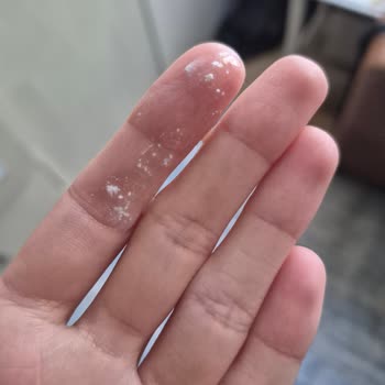 Bozuk Güneş Kremi Ve Mağduriyet: Ürün Değişimi Talebim Var