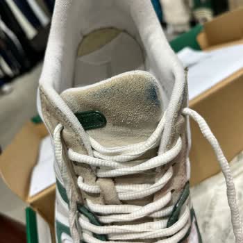 Kısa Sürede Renk Atan Ayakkabıya Kullanıcı Hatası Denmesi Şaşkınlık Yarattı