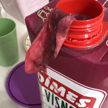 Dimes Vişne Suyunda Anormal Madde Ve İlgisiz Müşteri Hizmeti