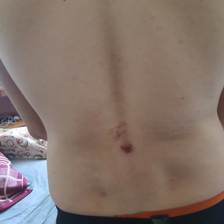 Adidas Eastrail 2.0 Ayakkabıda Taban Kayması Güvenliğimi Tehlikeye Atıyor