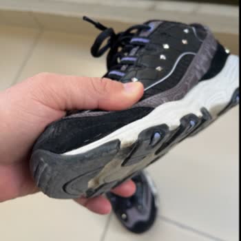 Skechers Ayakkabıda Garanti Süresinde Taban Açılması Ve Çözüm Sunulmaması