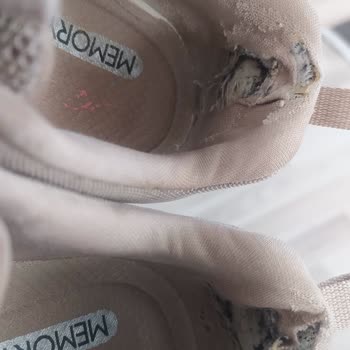 Kısa Sürede Deforme Olan Ayakkabıma Garanti Reddi: Mağduriyetimin Giderilmesini İstiyorum