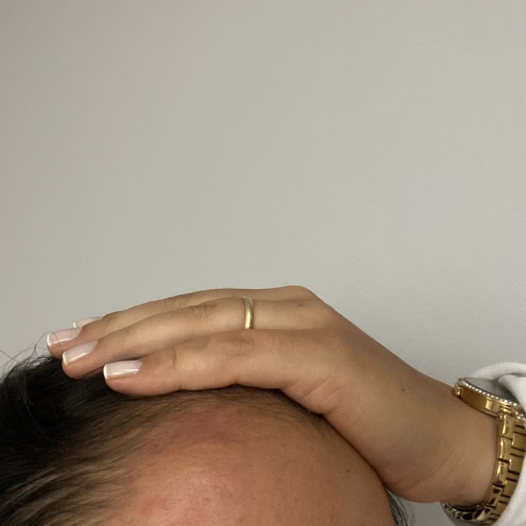 İETT Taksi Hizmetinde Bagaj Kapağı Kazası Ve Şoförün İlgisizliği