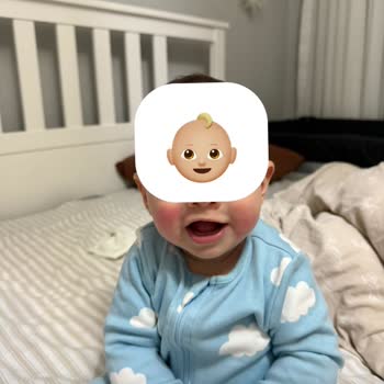 Uni Baby Islak Mendil Bebeğimde Alerji Ve Kötü Kokuya Sebep Oldu