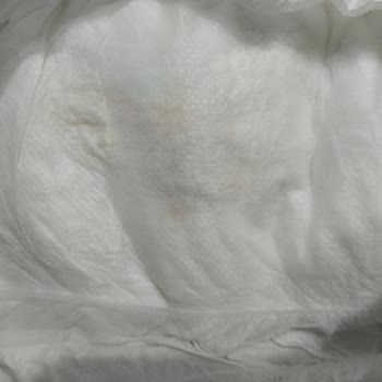 Sleepy Aldığım Bebek Bezlerinde Küf Benzeri Lekeler Çıktı, Mağduriyetim Giderilsin