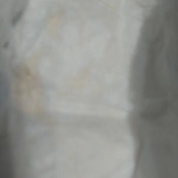 Sleepy Aldığım Bebek Bezlerinde Küf Benzeri Lekeler Çıktı, Mağduriyetim Giderilsin