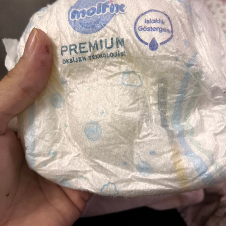 Aldığım Bebek Bezi Sürekli Sızdırıyor, Mağduriyetimin Giderilmesini İstiyorum