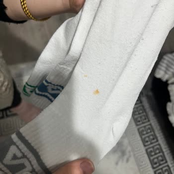 Beko Cm9120 Pas Lekesi Yapıyor!