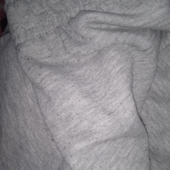 Yeni Alınan Eşofmanın Kısa Sürede Tüylenip Yıpranması Mağduriyet Yarattı