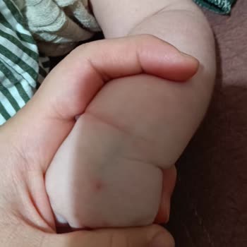 Bebek Hastaya Damar Yolu Açılamadı Personel Deneyimsizliği Mağduriyet Yaşattı