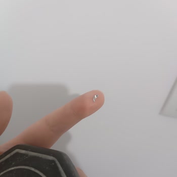 Sabunun İçinden Çıkan Sivri Metal Cildimi Yaralayabilirdi