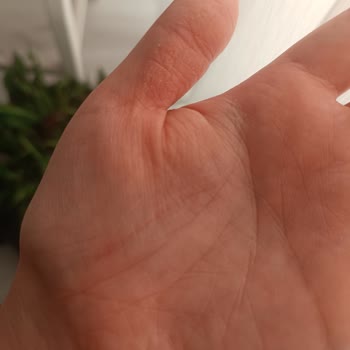 Sabunun İçinden Çıkan Sivri Metal Cildimi Yaralayabilirdi