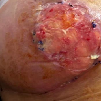 Vita Estetik’te Başarısız Ameliyatlar Ve Mağduriyetim Giderilmiyor