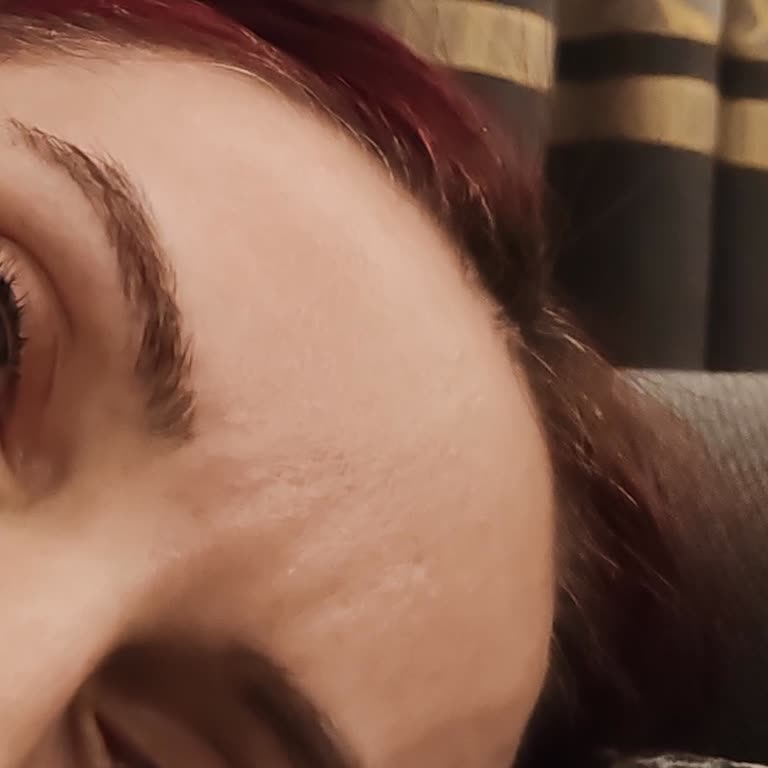 Liva Clinic’te Yapılan Botox Ve Dolgu İşlemlerinin Hızla Etkisizleşmesi Ve Yetersiz Bilgilendirme