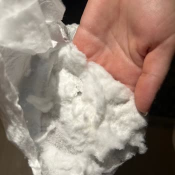 Molfix Bebek Bezlerinde Sertlik Sorunu Ve Müşteri Hizmetlerinden Dönüş Alamadım