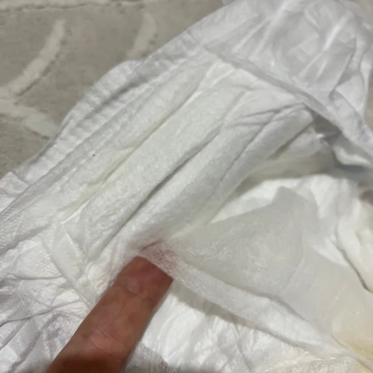 Molfix 5 Numara Bebek Bezinde Sürekli Sızıntı Ve Islaklık Göstergesi Sorunu