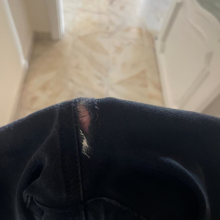 Mavi Jean Pantolonun Hızla Deforme Olması Ve Yetersiz Çözüm Sunulması