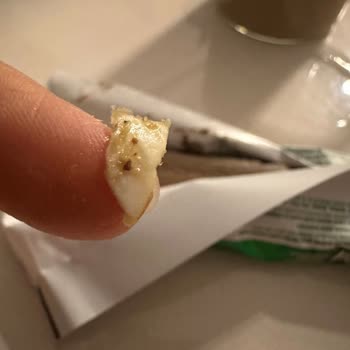 Kahve Dünyası Gofrik Çikolatadan Çıkan Plastik Parça Yüzünden Yaşadığım Tehlike