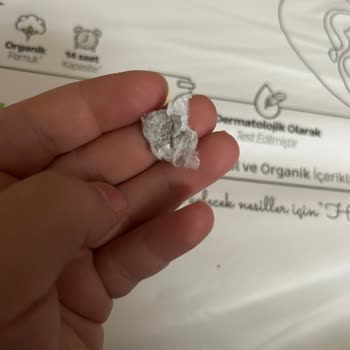 Bebek Bezinde Sakız Benzeri Yabancı Maddeyle Karşılaştım Hijyen Endişesi Yaşıyorum