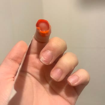 Kapsül Tırnak İşlemi Sonrası Ağrı Ve Kırılma, Ücret İadesi Talebi