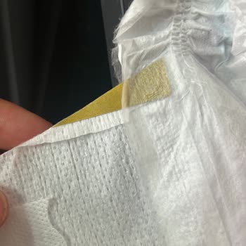 Molfix Bebek Bezinde Sert Cisim Çıktı, Yenisiyle Değişim Talep Ediyorum