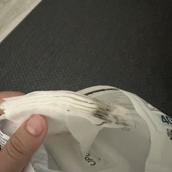 Islak Mendil Paketlerinde Küf Oluşumu İle Karşılaştım, Sağlık Riski Yaşadım