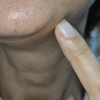 Yetersiz Hizmet Ve Saygısız Yaklaşımla Mağduriyet Yaşadım