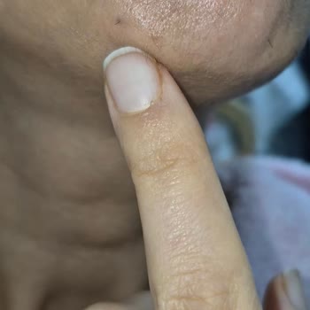 Yetersiz Hizmet Ve Saygısız Yaklaşımla Mağduriyet Yaşadım