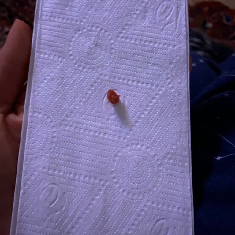 Kasap Sucukta Çıkan Büyük Kemik Parçası Tedirginlik Yarattı