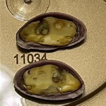 Küflü Antep Fıstığı: Sağlığım Tehlikeye Girdi