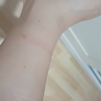 İlk Kullanımda Ayağımı Yaralayan Bot İçin İade Talebim Var