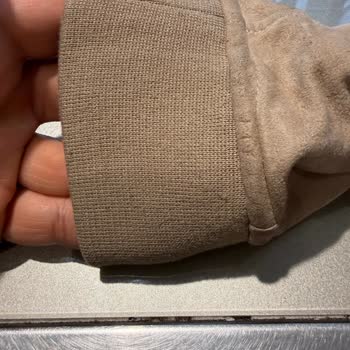 Yeni Alınan Montta Hızlı Tüycüklenme Ve Çözülmeyen Sorun