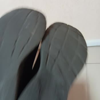 Skechers Ayakkabının Tabanı Hızla İnceldi, Mağaza Çözüm Sunmadı