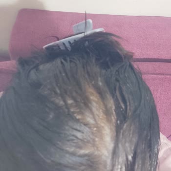 Ağış Saç Açıcı Ürün Beklenen Sonucu Vermedi, Para İadesi Talebim Var