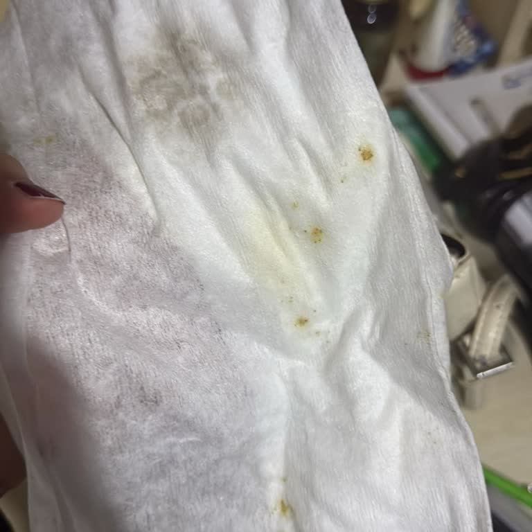 Sleepy Yüzey Temizleyici Havludan Çıkan Lekeli Ve Kirli Mendiller Hijyen Endişesi Yarattı