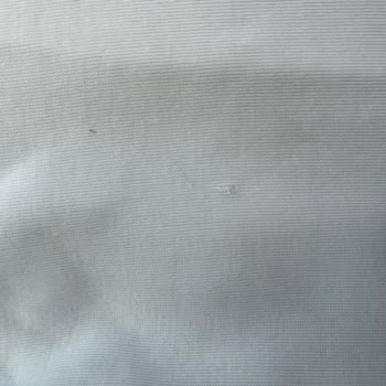 Kısa Sürede Açılan Dikişler Ve Olumsuz Mağaza Yaklaşımı Nedeniyle Ürün Değişimi Talebi