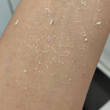 Son Kullanma Tarihi Eksik Ve Ürün Bozuk Çıktı, Mağduriyet Yaşadım