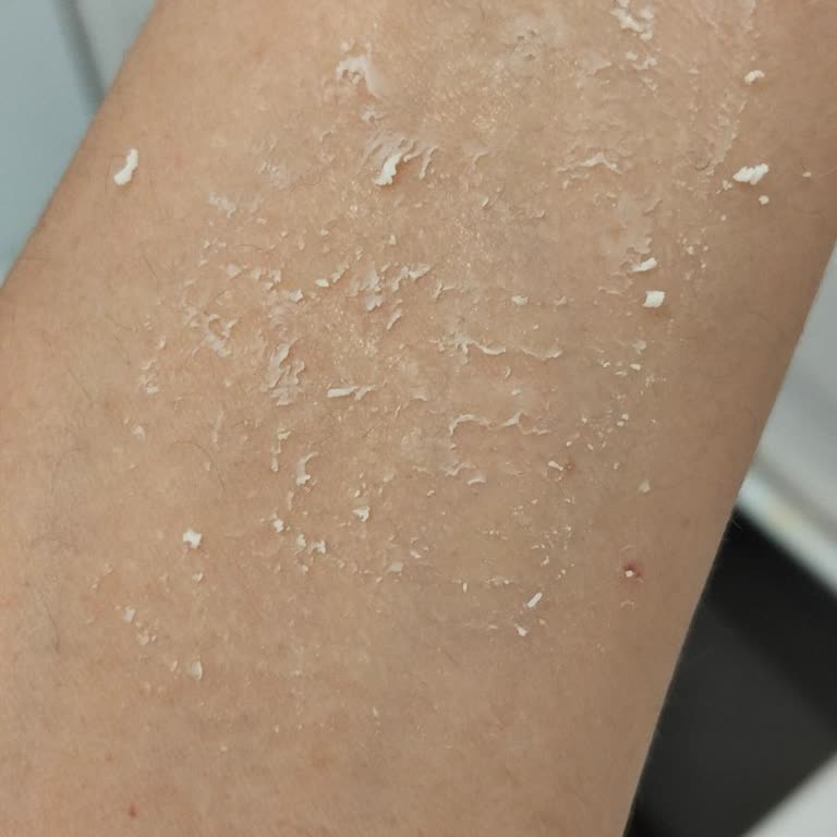 Son Kullanma Tarihi Eksik Ve Ürün Bozuk Çıktı, Mağduriyet Yaşadım
