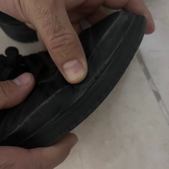 Kısa Sürede Açılan Ayakkabıya Rağmen Değişim Talebim Reddedildi