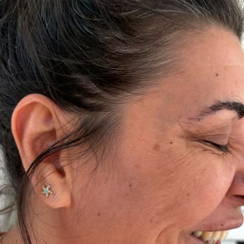 Roxxann Clinic Estetik İşlem Sonrası Mağduriyet Ve Profesyonellikten Uzak Yaklaşım!