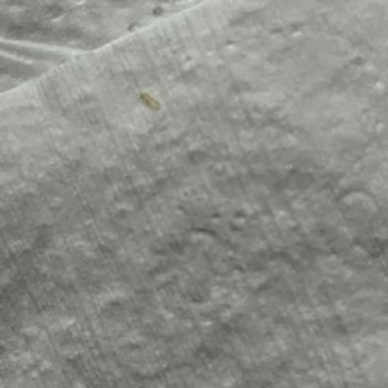 Bebek Temizleme Pamuğunda Tahta Parçası Şoku!