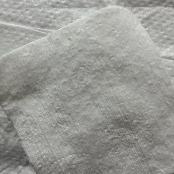 Bebek Temizleme Pamuğunda Tahta Parçası Şoku!