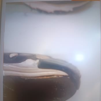 Pointspor Kısa Sürede Açılan Skechers Ayakkabı İçin Garanti Kapsamında Destek Alamama